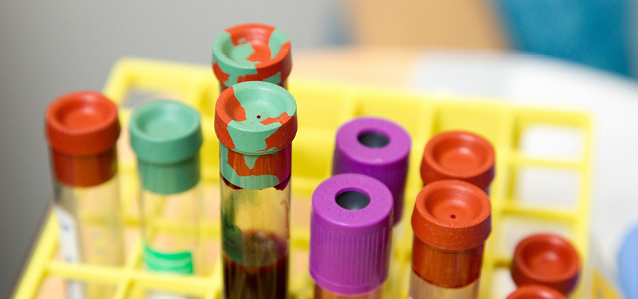 colorful containers with blood samples in a yellow tray